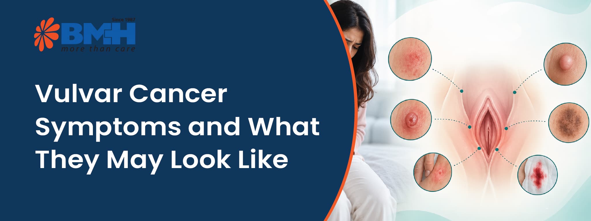 Vulvar Cancer Symptoms01