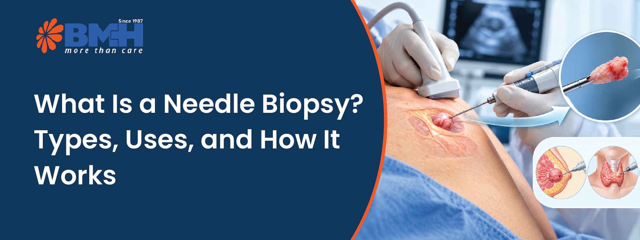 what-is-a-needle-biopsy-01
