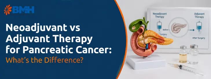 Neoadjuvant vs Adjuvant Therapy for Pancreatic Cancer 1