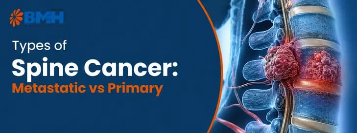 Types of Spine Cancer 1