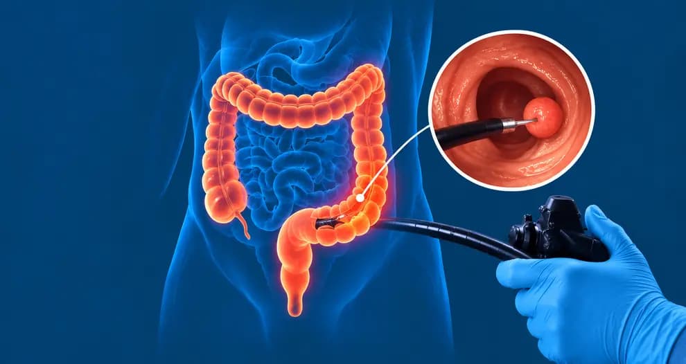 Current Colonoscopy Screening Guidelines: Age & Tests