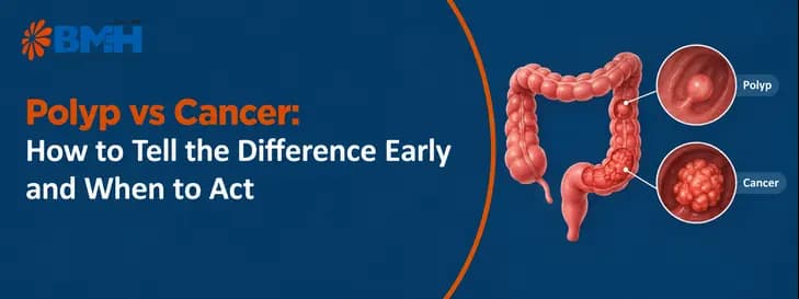 Polyp-vs-Cancer-Know-the-Difference-01
