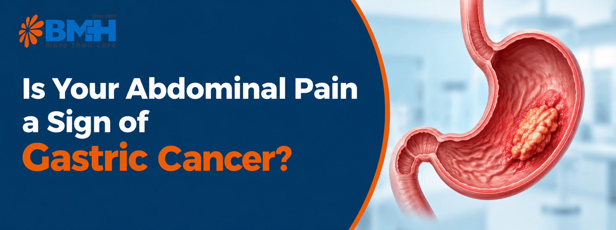 is-your-abdominal-pain-a-sign-of-gastric-cancer-01