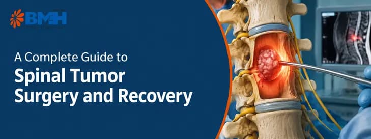 Spinal Tumor Surgery and Recovery 1