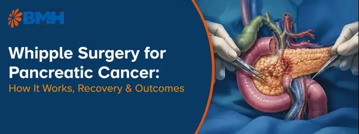 Whipple Surgery for Pancreatic Cancer 1