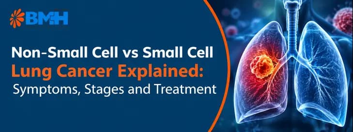 Non-Small Cell vs Small Cell Lung Cancer01